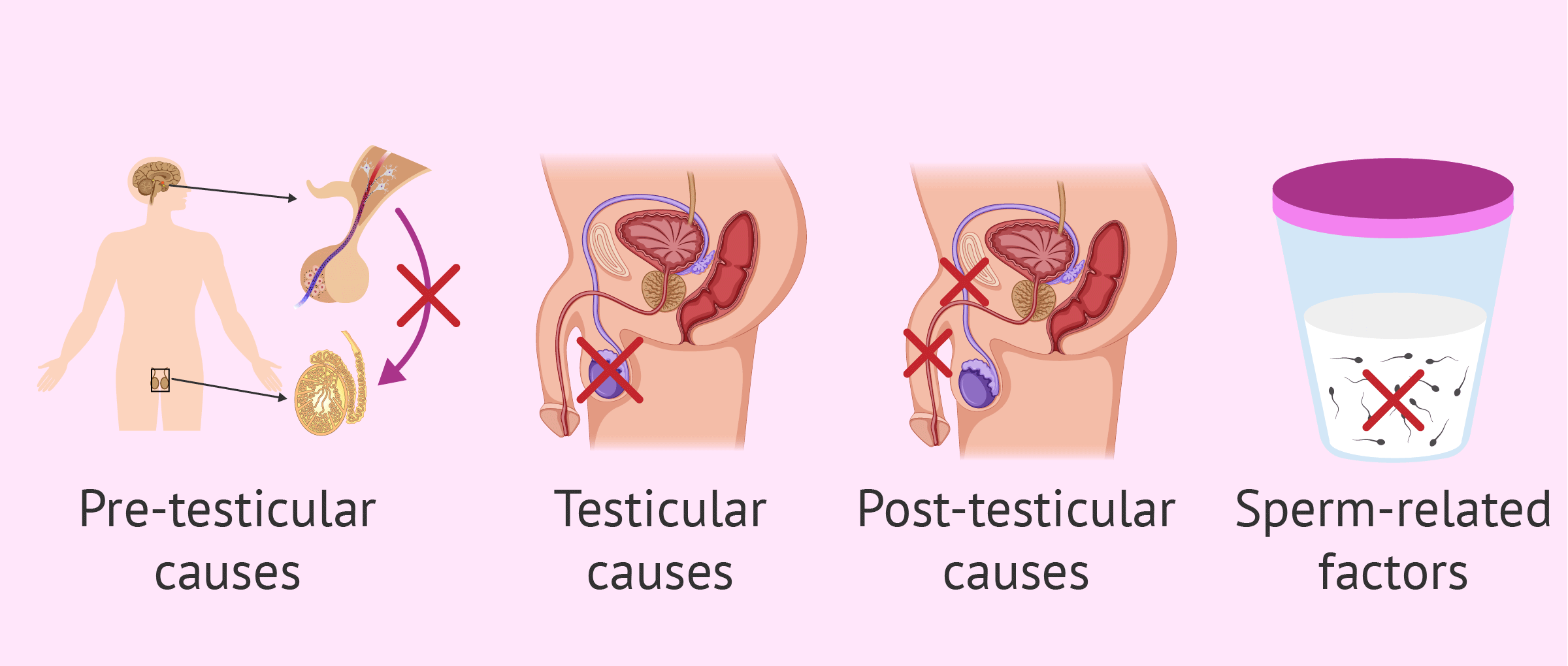 Male-sterility-causes