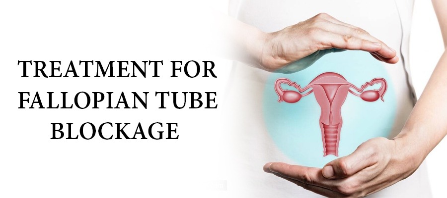 Fallopian-Tube-Blockage-Treatment-Without-Surgery
