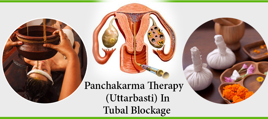 Blocked Fallopian tube