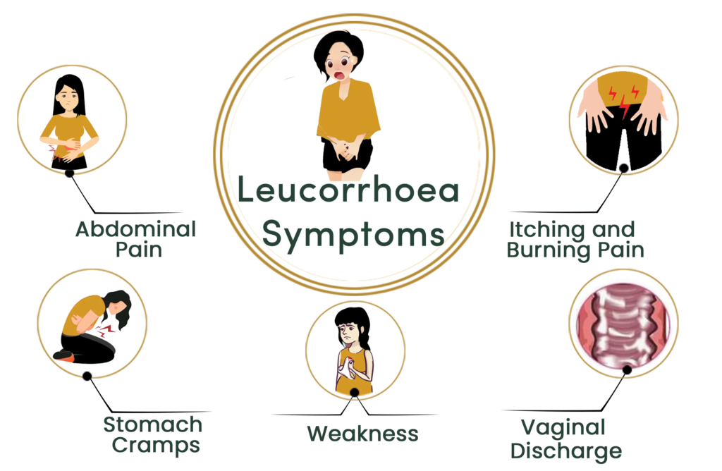 leucorrhoea-symptoms